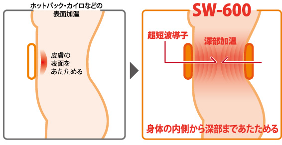 ホットパック・カイロなどの表面加温：皮膚の表面をあたためる。→SW-600：超音波導子による深部加温により身体の内側から深部まであたためる。
