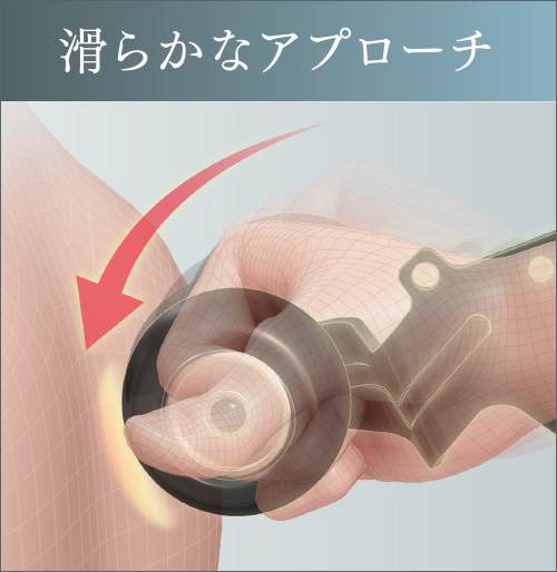滑らかなアプローチ